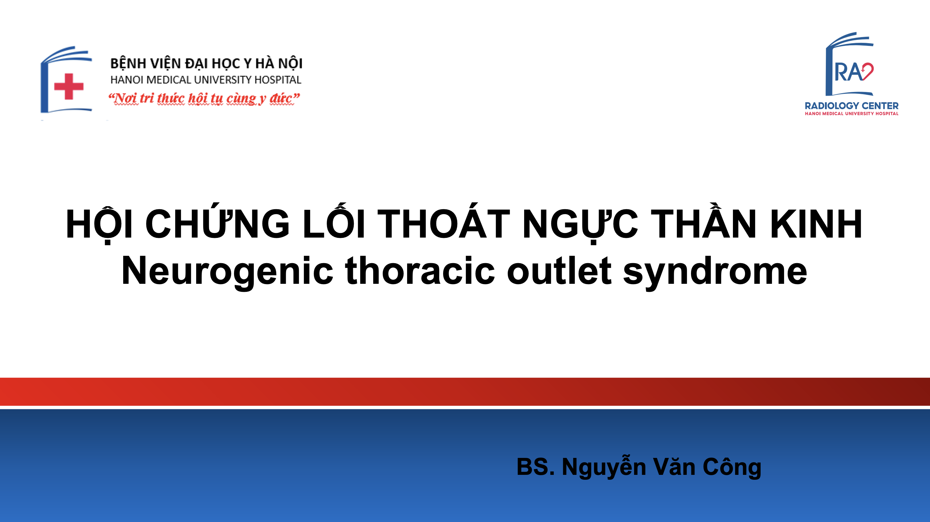 Hội chứng lối thoát ngực thần kinh (neurogenic thoracic outlet syndrome – nTOS)