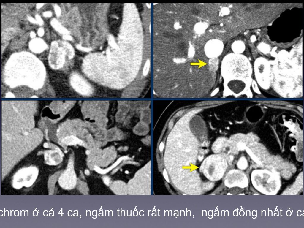 Trung tâm chẩn đoán hình ảnh và can thiệp điện quang – Bệnh viện Đại học Y Hà Nội