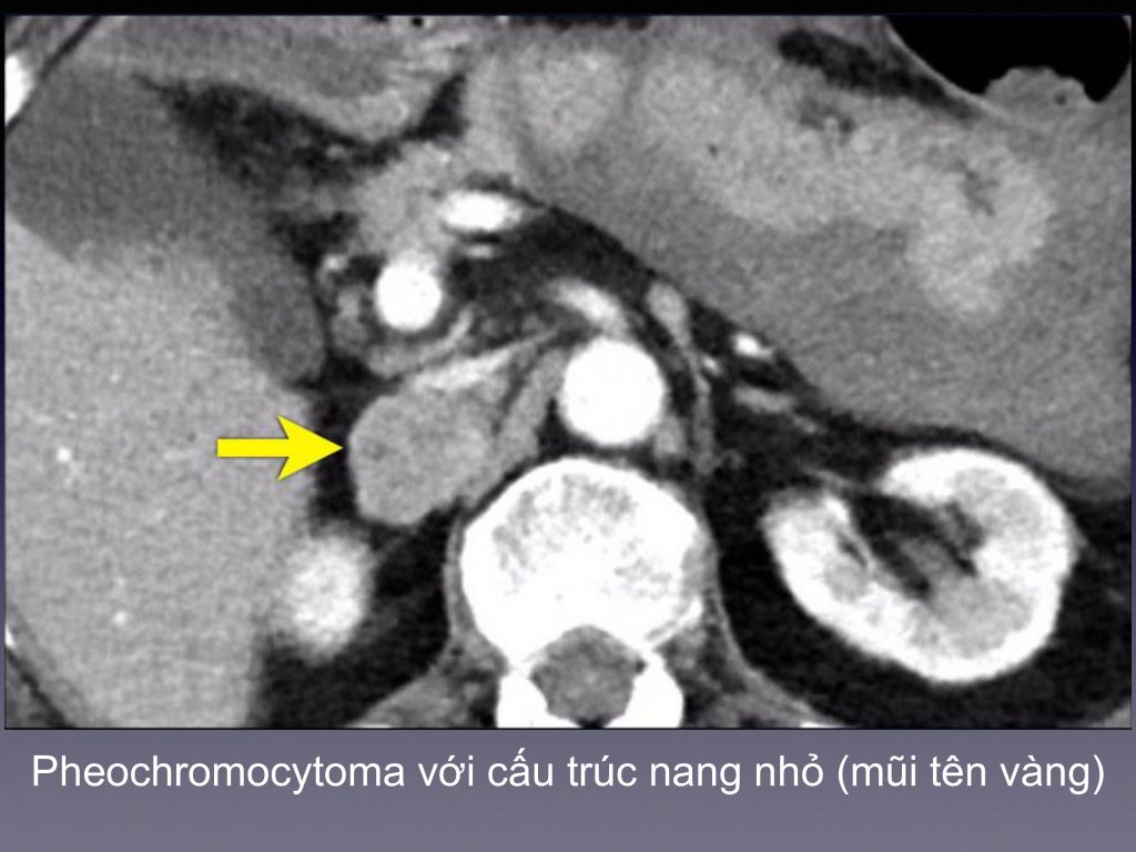 Trung tâm chẩn đoán hình ảnh và can thiệp điện quang – Bệnh viện Đại học Y Hà Nội