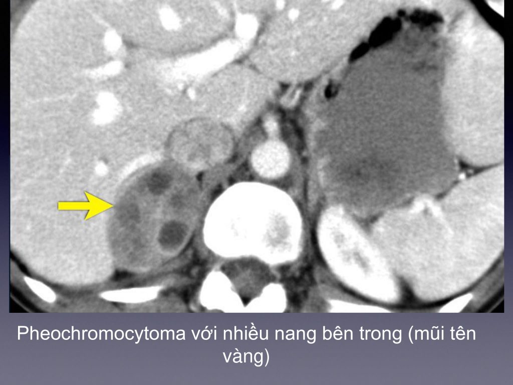 Trung tâm chẩn đoán hình ảnh và can thiệp điện quang – Bệnh viện Đại học Y Hà Nội