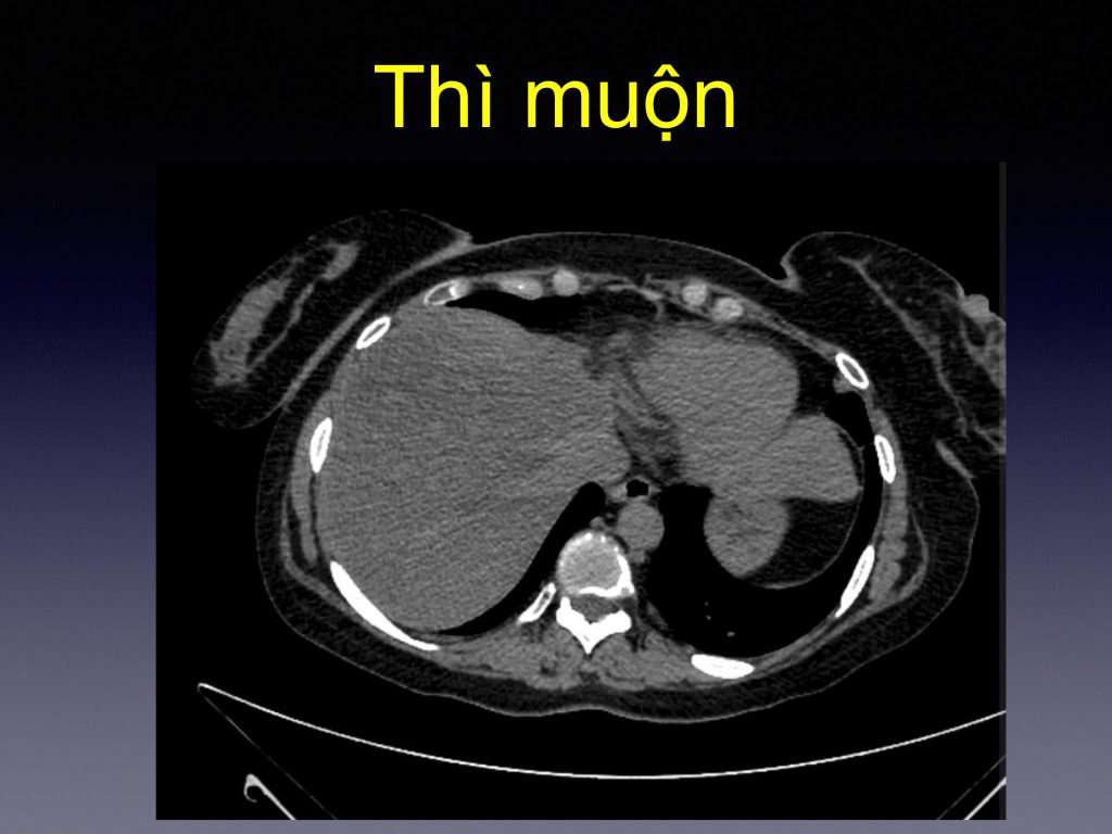 Trung tâm chẩn đoán hình ảnh và can thiệp điện quang – Bệnh viện Đại học Y Hà Nội
